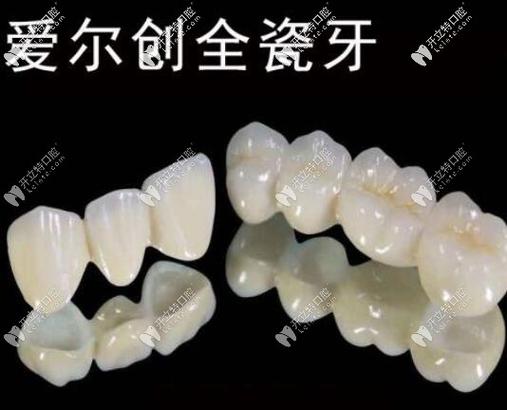成都深圳全瓷牙怎么选？这三家口碑好的牙科别错过