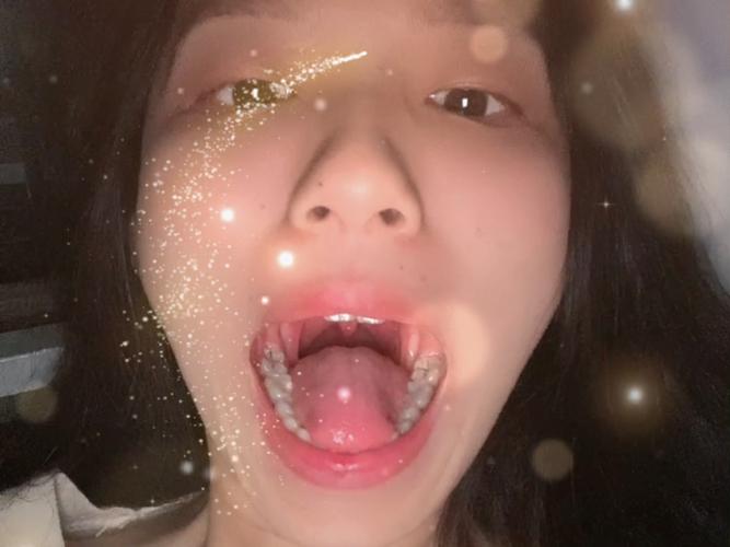 成都口腔检查第一视角真的有用吗？