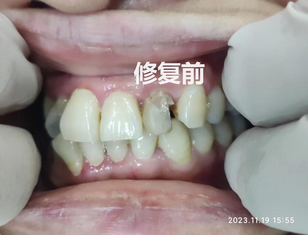 成都口腔诊疗服务怎么挑不踩坑？看牙前你最好先把这几条搞明白