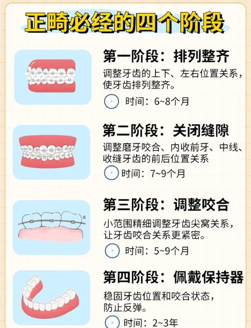 成都26岁牙齿矫正要几年？过来人告诉你1.5-3年就够了