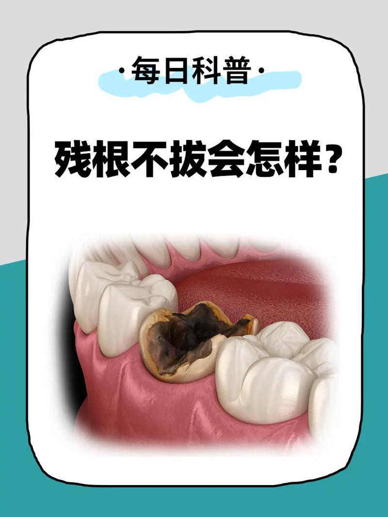 种植牙拔掉后有过渡牙吗_大牙拔掉后不种植会怎么样_拔大牙后种牙