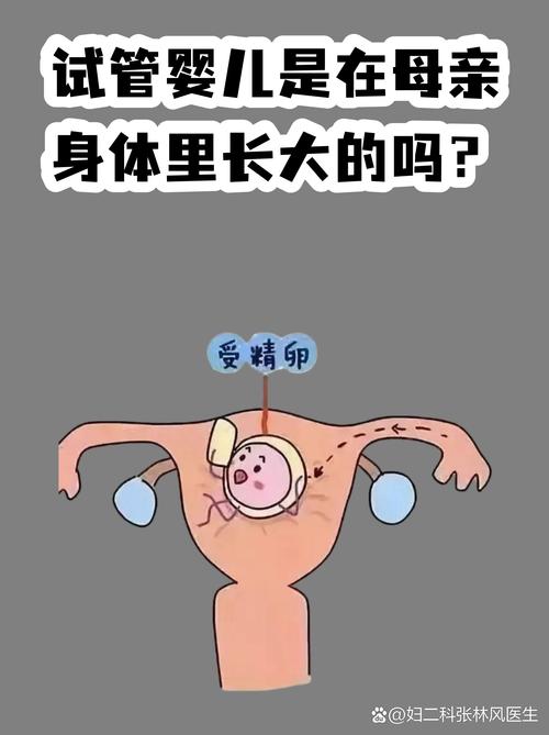 成都试管婴儿常见误区有哪些 专家一次说清