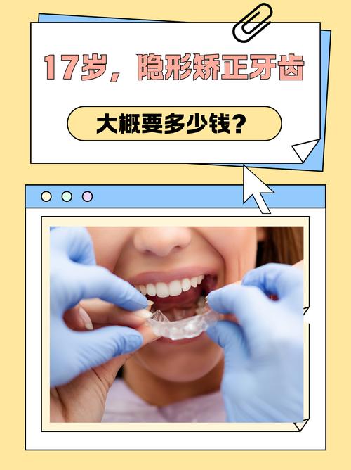 成都德韩隐形矫正牙齿效果好吗 价格多少