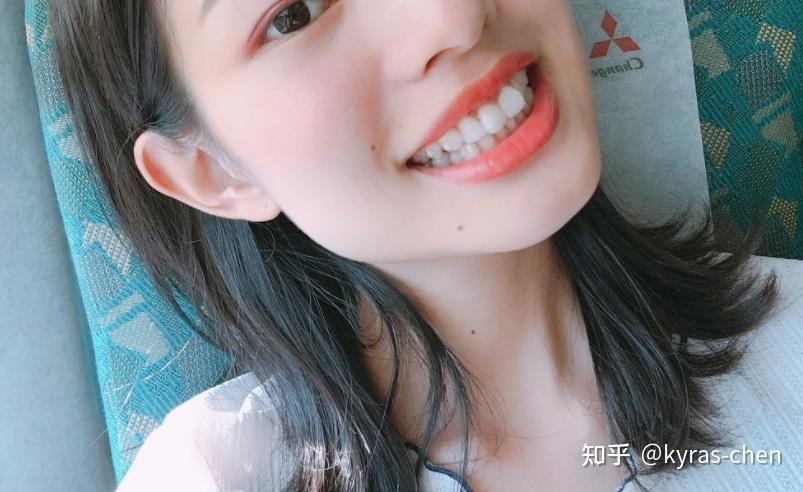 成都成人门牙不齐矫正真的很简单吗