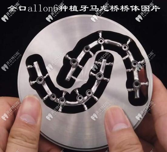 成都深圳半口All-on-4种植牙医院怎么选？地址与避坑指南