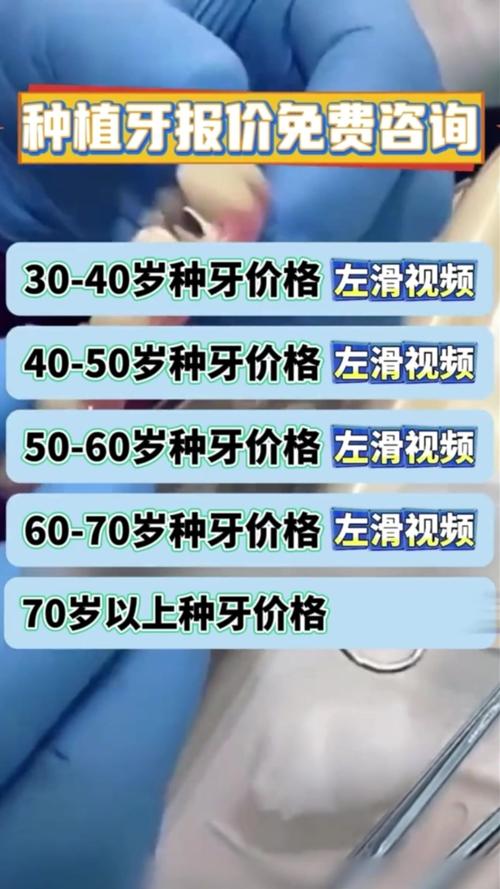 成都南充半口种牙到底要花多少钱?2026年真实报价揭秘