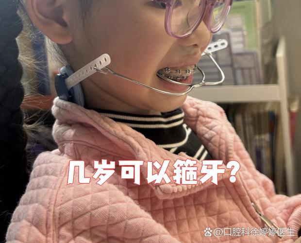 成都11岁孩子牙齿矫正，到底合不合适？