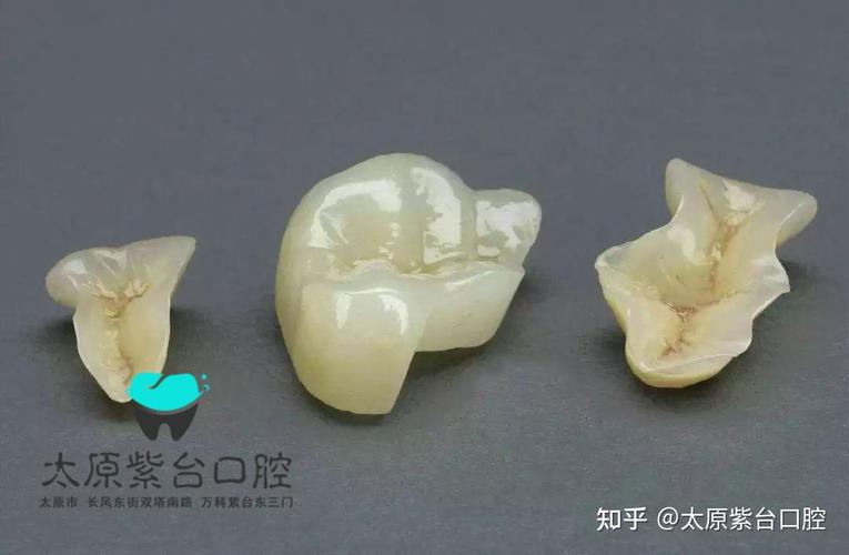 成都口腔检查反馈单看不懂?3步教你秒读