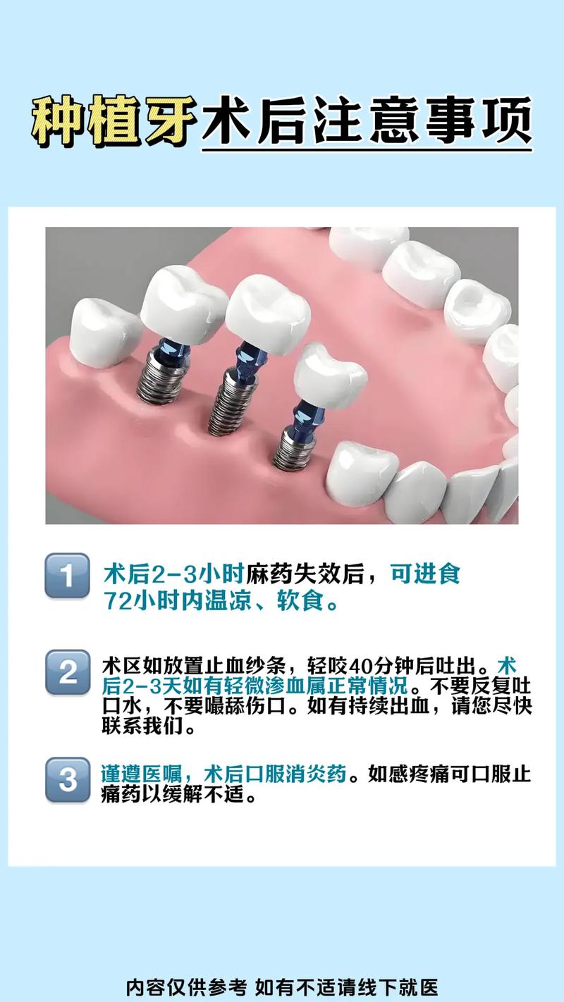 成都种植牙的优缺点和寿命 手术疼不疼