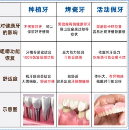 成都赤峰种牙别乱选 公立三甲医院才靠谱