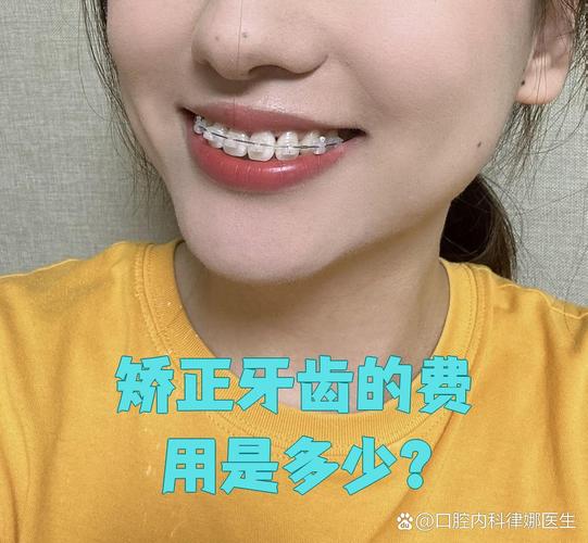 成都纠正牙型费用全解析:矫正牙齿一般要多少钱