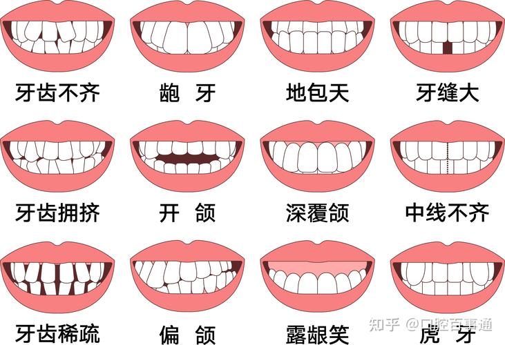 成都25岁矫正牙齿还来得及吗真实经历分享