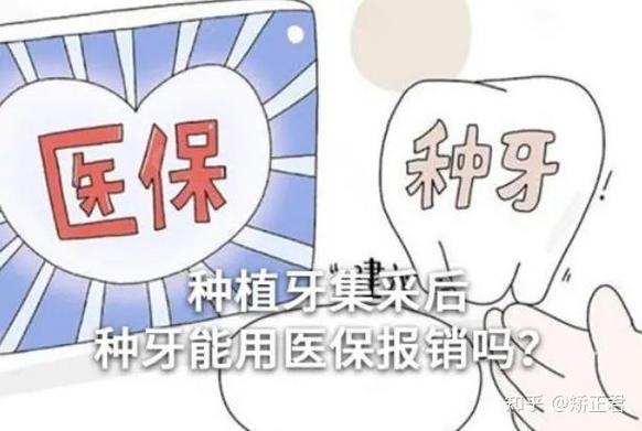 成都深圳种植牙医保报销政策最新解读