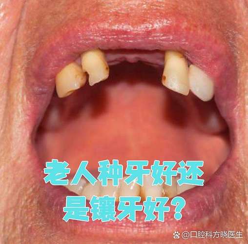 成都74岁老人种牙晚不晚？医生揭秘高龄种植的真实风险与收益