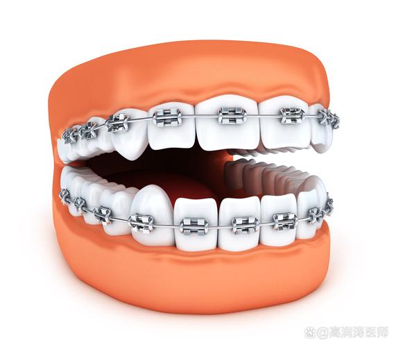 成都宜昌牙齿矫正效果怎么样？真的靠谱吗