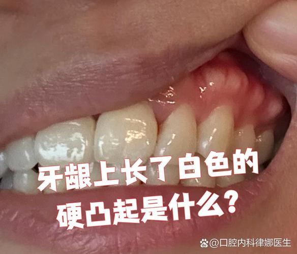 成都缺一颗牙一定要种吗 不种的后果你承受得起吗