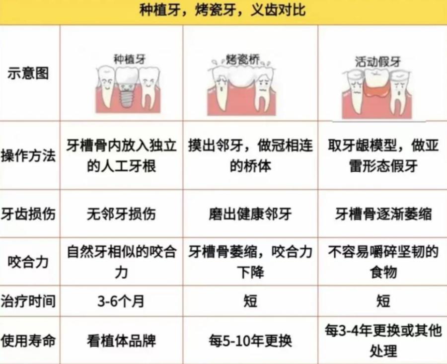 成都2万块种牙到底够不够 真实费用全解析