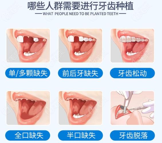 成都保定口腔医院收费多少钱？看牙项目全解析