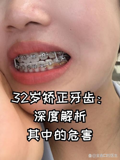 成都26岁做牙齿矫正来得及吗？牙周健康是关键