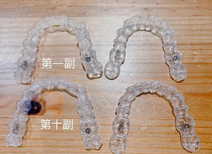 椒江隐适美牙齿矫正多少钱_隐适美矫正价格2万五_隐适美矫正公司