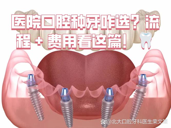 成都深圳连锁牙科种牙贵不贵？值不值得选？