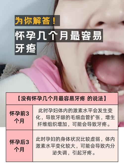 成都经期孕期感冒期，期间可以种牙吗？看身体状态定
