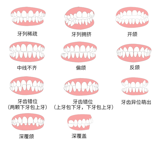 成都30岁做牙齿矫正到底值不值 利与弊全分析