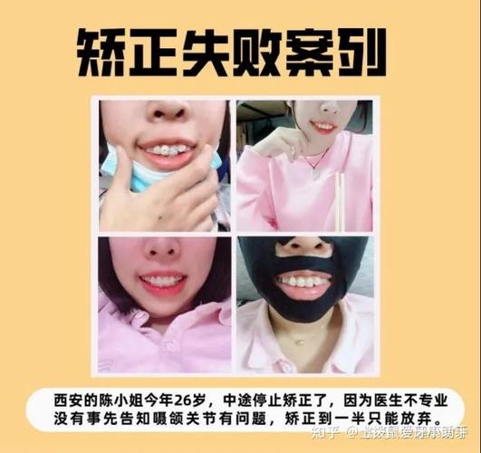 成都临沧牙齿矫正医院排名：这三家才是真靠谱