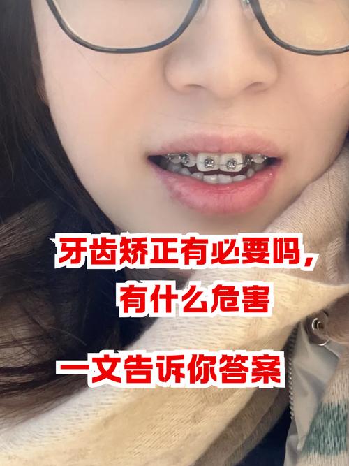 成都13岁牙齿矫正有后遗症吗？会松动、牙套脸？家长必看