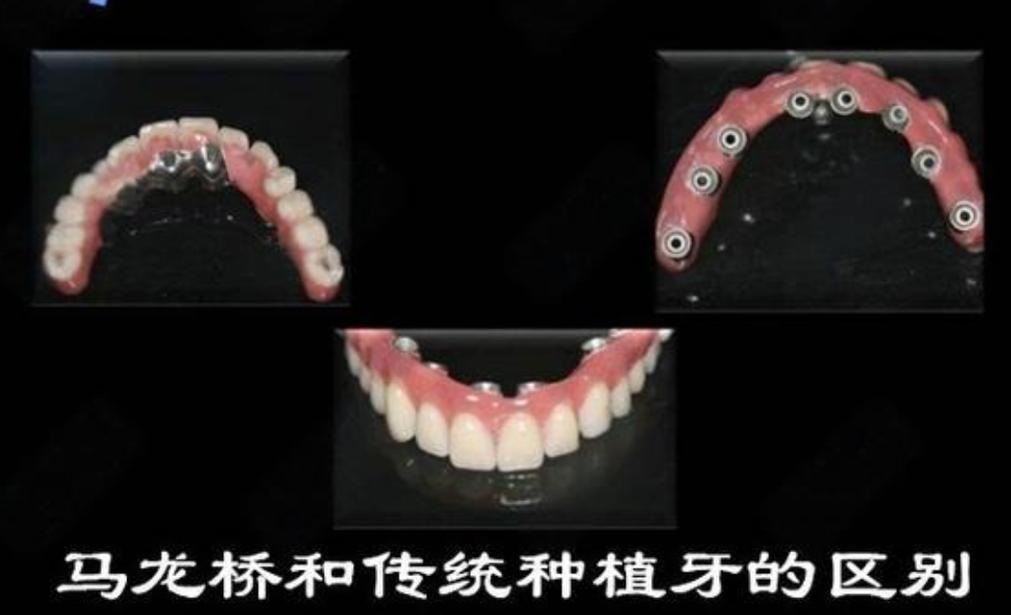 成都大同种牙哪里好 选公立还是私立更靠谱