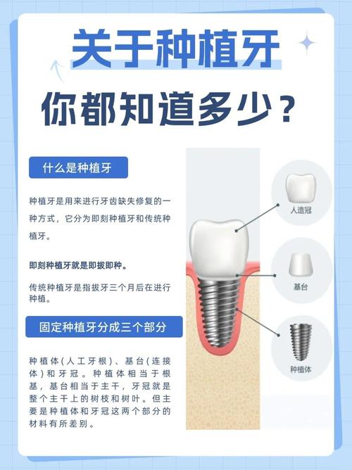 成都4颗牙一起种到底靠不靠谱 种植医生一次性讲清楚