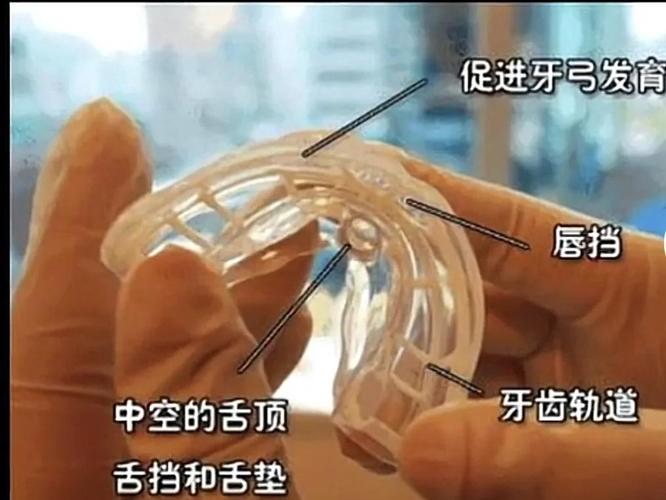 成都深圳南山儿童隐形MRC矫正费用到底多少钱？