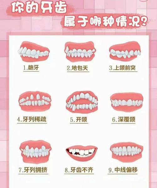 成都孩子几岁矫正牙齿最好 成人还能矫正吗
