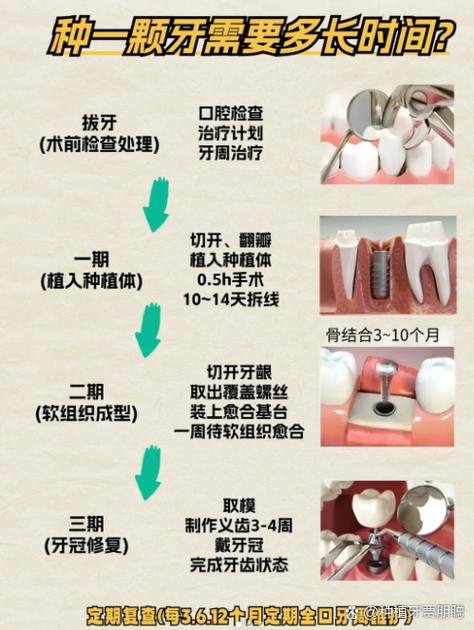 成都种牙前做CT是必须的吗 2026种牙CT检查费用全解析