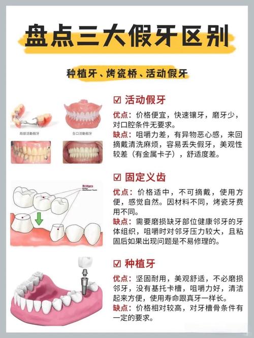 成都牙齿掉了是种牙还是镶牙 种牙过程和价格一文说清