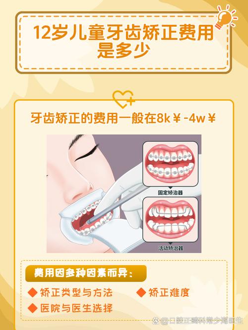成都12岁矫正牙齿要多少钱？医生揭秘各阶段费用明细