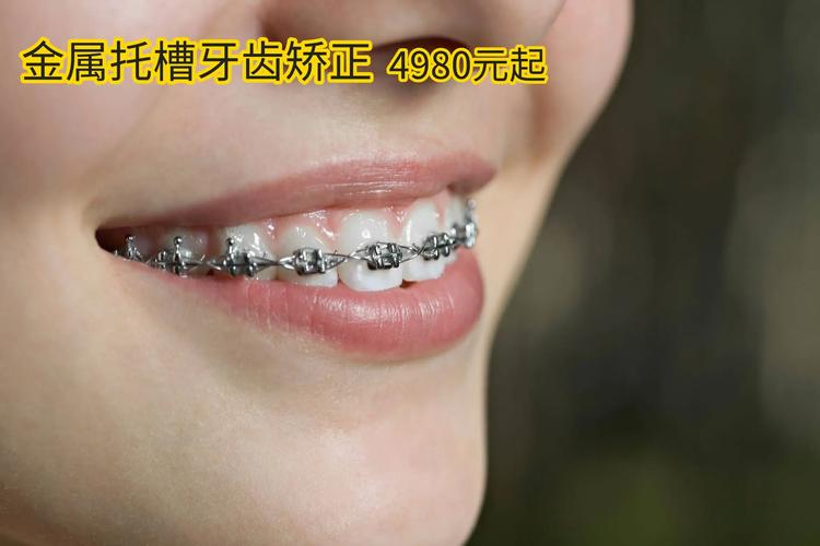 深圳比较好的牙齿矫正医院_深圳十大牙齿矫正医院_深圳牙齿矫正医院