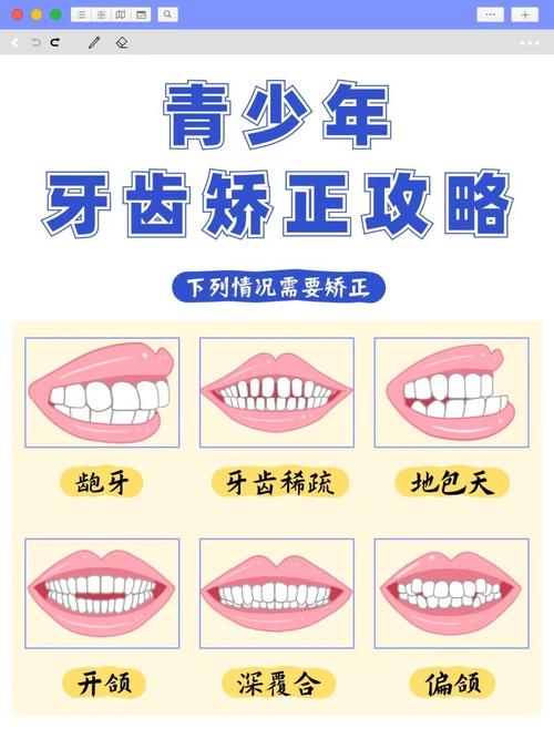 成都15岁牙齿不齐别慌！抓住矫正黄金期，这些方法快收藏