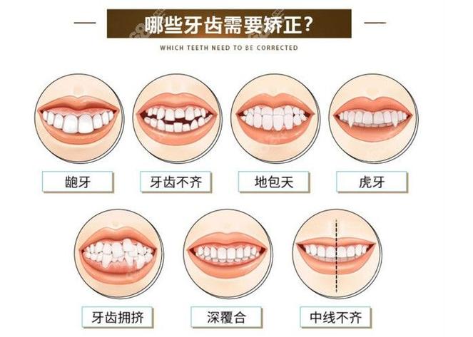 成都38岁矫正牙齿晚不晚 别让年龄成为你犹豫的借口