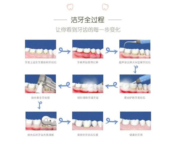 成都深圳宝安隐适美正品认证医院怎么选？