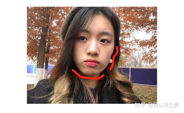 成都莲塘小孩正畸多少钱？费用明细和避坑指南