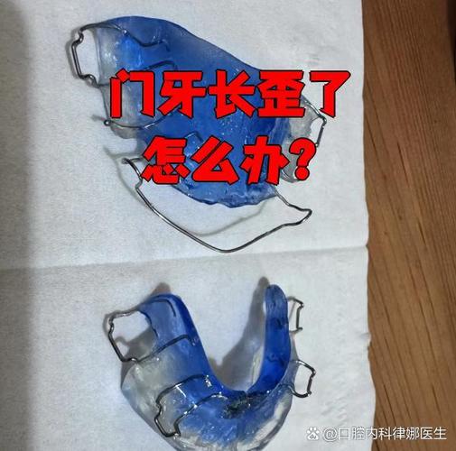 成都牙齿长歪了怎么矫正?多少钱能搞定?