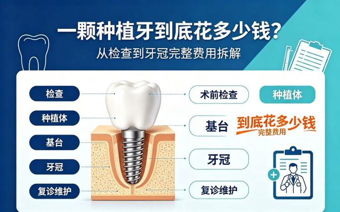 成都去口腔医院种一颗牙得花多少钱?详细拆解告诉你