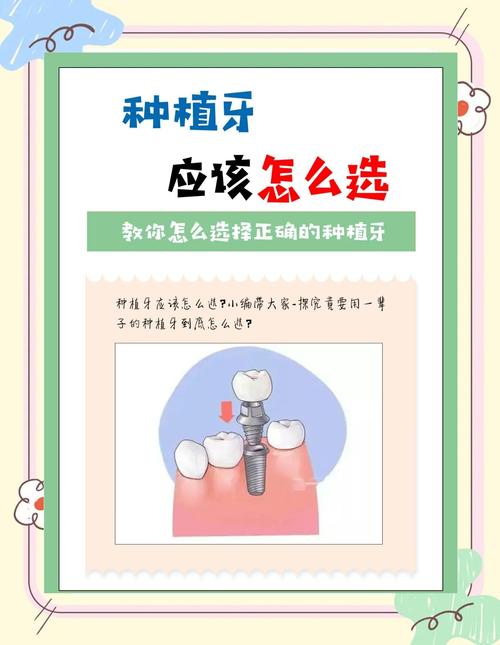 成都附近牙科种牙怎么选？这份避坑指南请收好