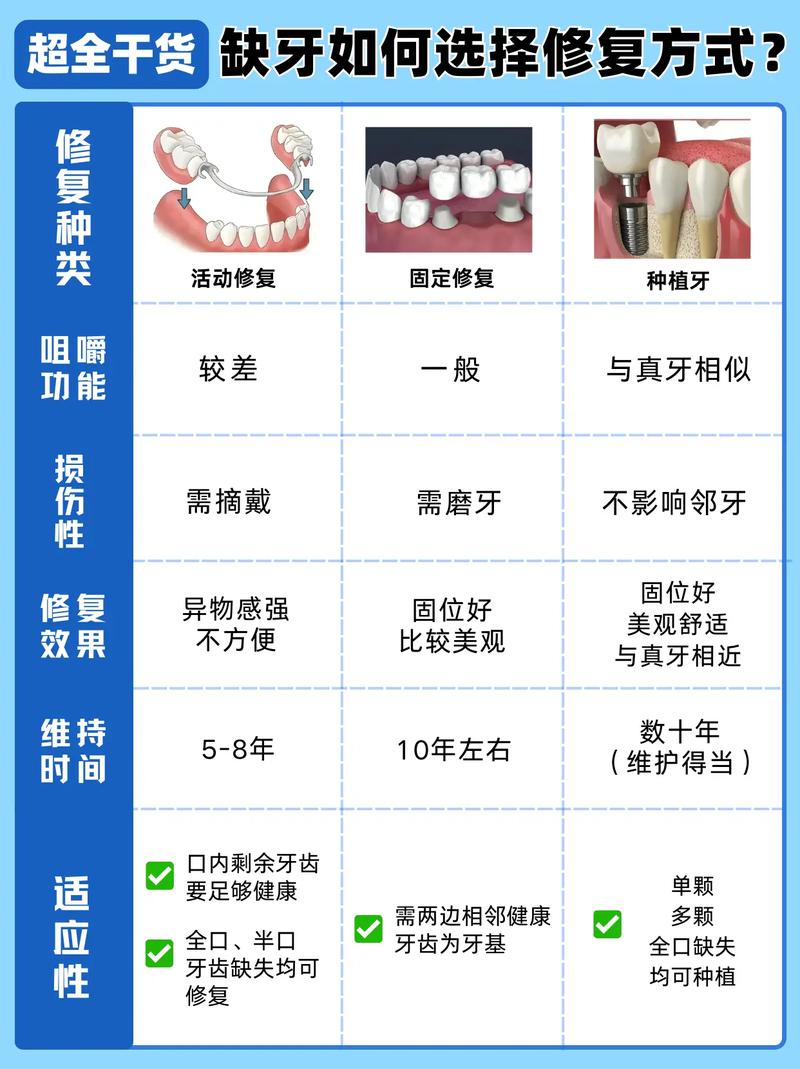 成都补牙种牙镶牙怎么选？牙医一次说清楚