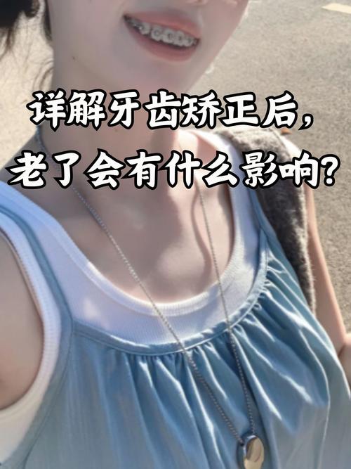 成都40岁还能矫正牙齿吗？看完这篇文章让你了解40岁牙齿矫正的真相
