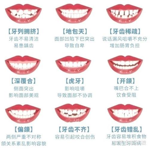 矫正门牙需要多少钱_暴门牙矫正要多少钱_矫正门牙费用