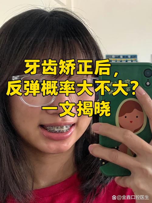 成都19岁做牙齿矫正晚不晚 过来人告诉你真实经历