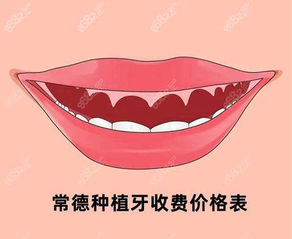 成都常德半口种植牙费用2026大概多少钱？真实价格参考