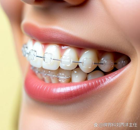 成都深圳隐形牙齿矫正价格是多少？多少钱能搞定？